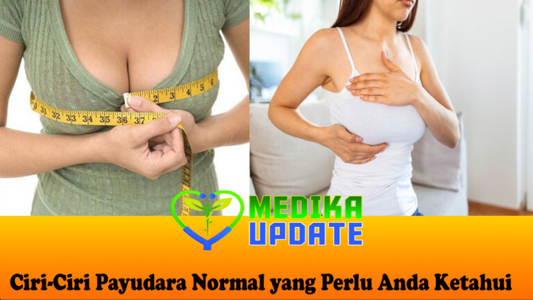 Ciri-Ciri Payudara Normal yang Perlu Anda Ketahui