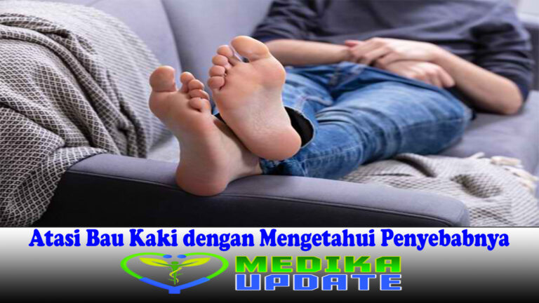 Atasi Bau Kaki dengan Mengetahui Penyebabnya